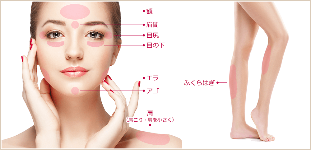 ボツリヌス注射 注入部位